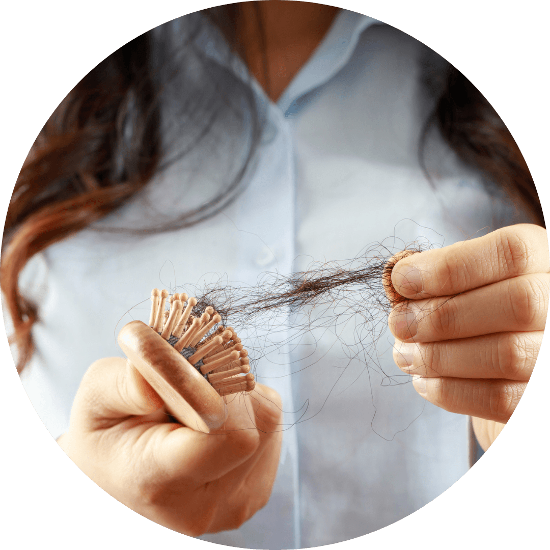 Menopausal Hair Loss Causes And Treatments Nufemme Clinic